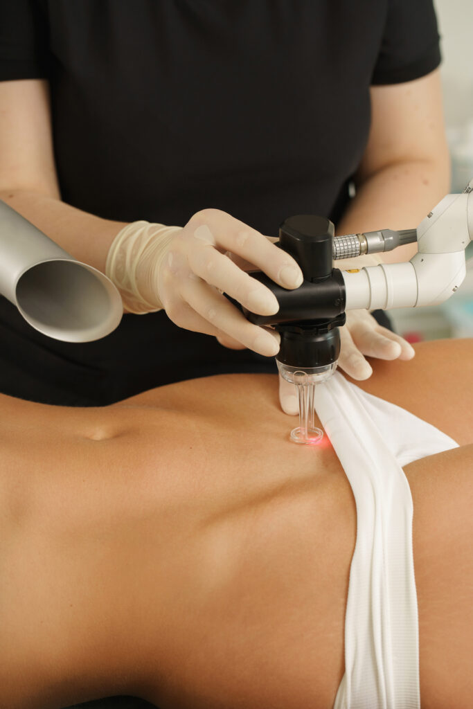 Laser treatment and scar removal after C-section surgery in a medical aesthetic clinic